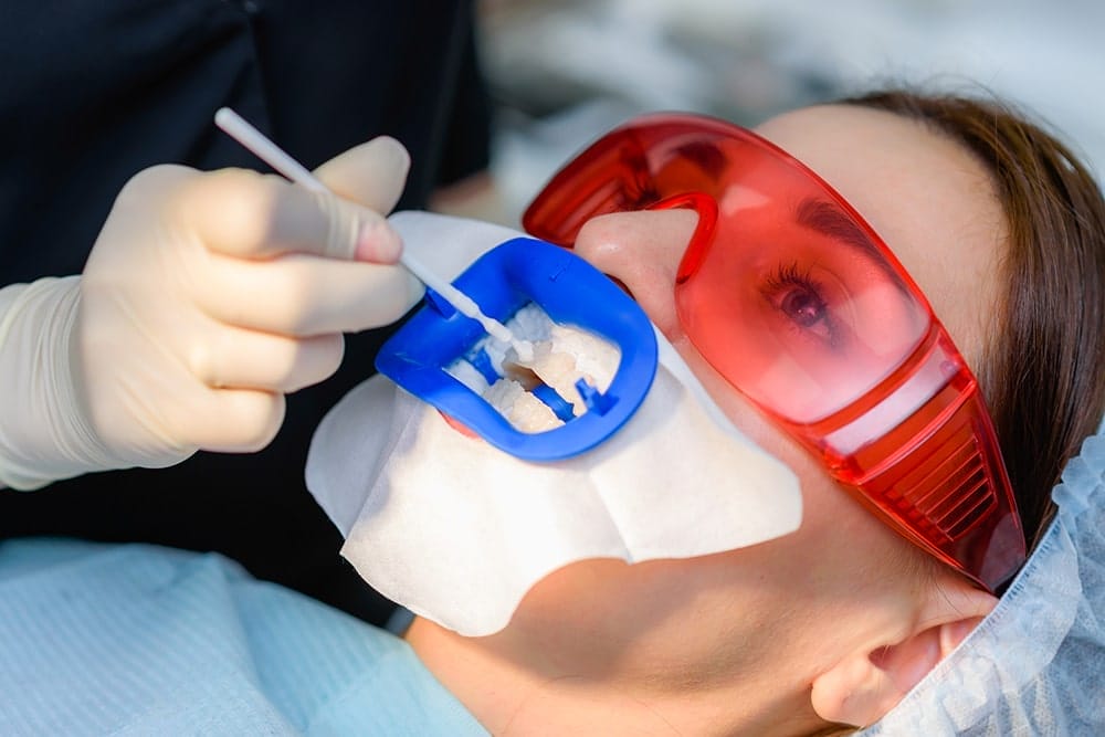 Dental professional preparing an in-office teeth whitening treatment using a UV lamp while the patient wears protective goggles.